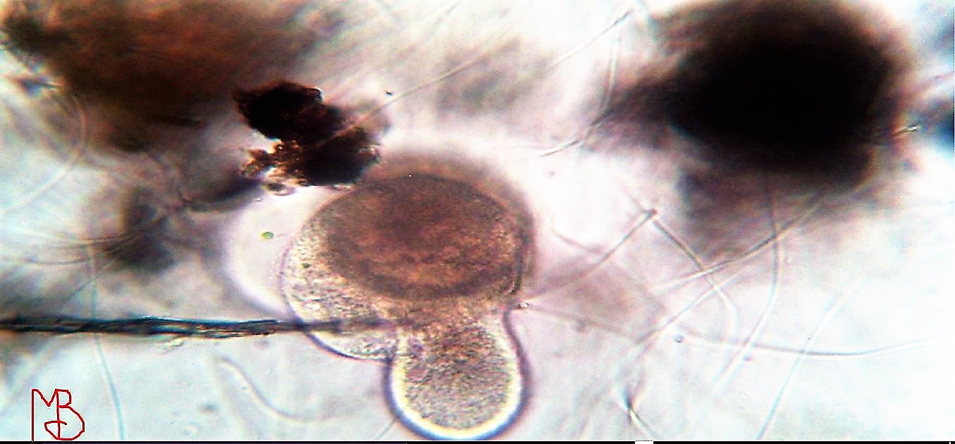 Ciliato da determinare